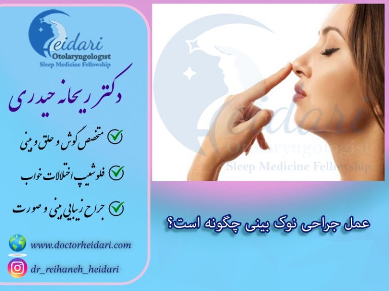 عمل نوک بینی عمل نوک بینی