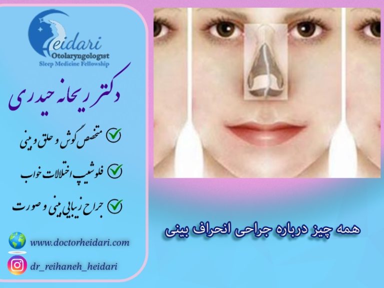 همه چیز درباره جراحی انحراف بینی همه چیز درباره جراحی انحراف بینی