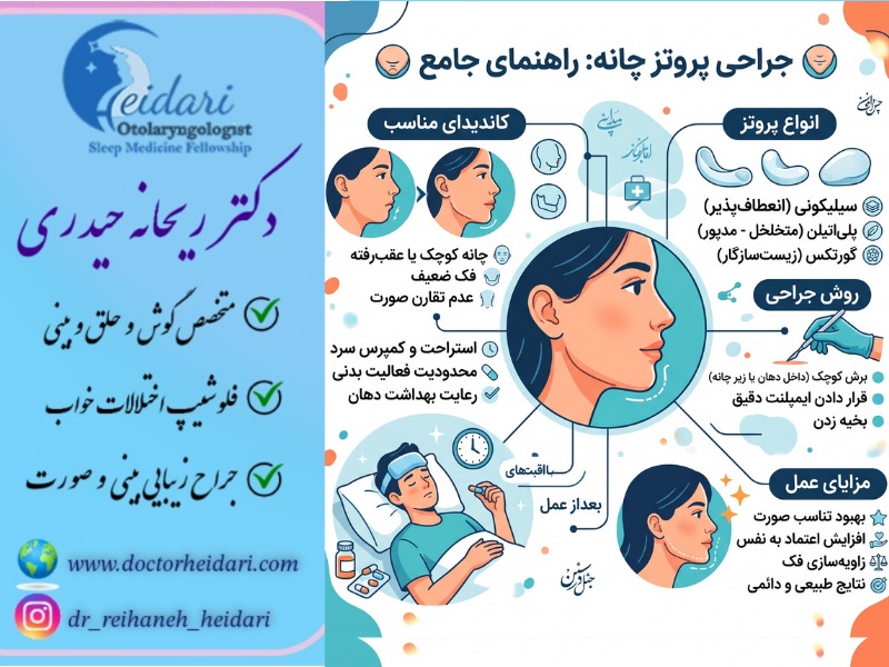 عمل جراحی پروتز چانه
