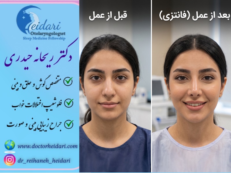 عکس بینی فانتزی