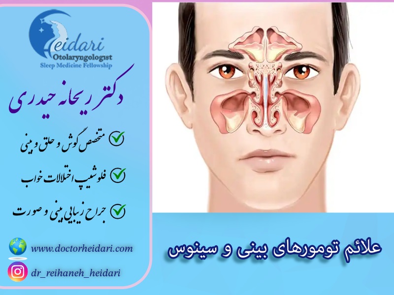علائم تومورهای بینی و سینوس