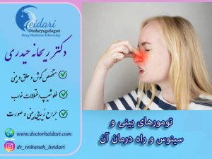 تومورهای بینی و سینوس و راه درمان آن