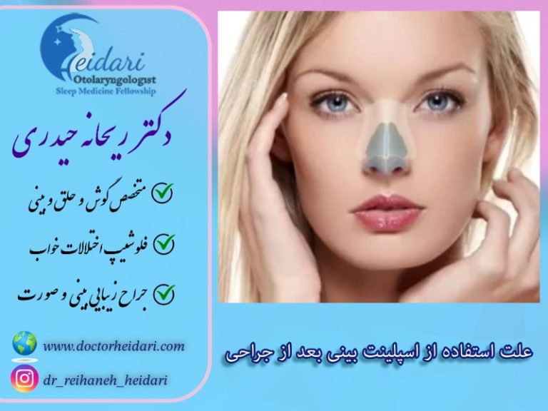 علت استفاده از اسپلینت بینی بعد از جراحی علت استفاده از اسپلینت بینی بعد از جراحی