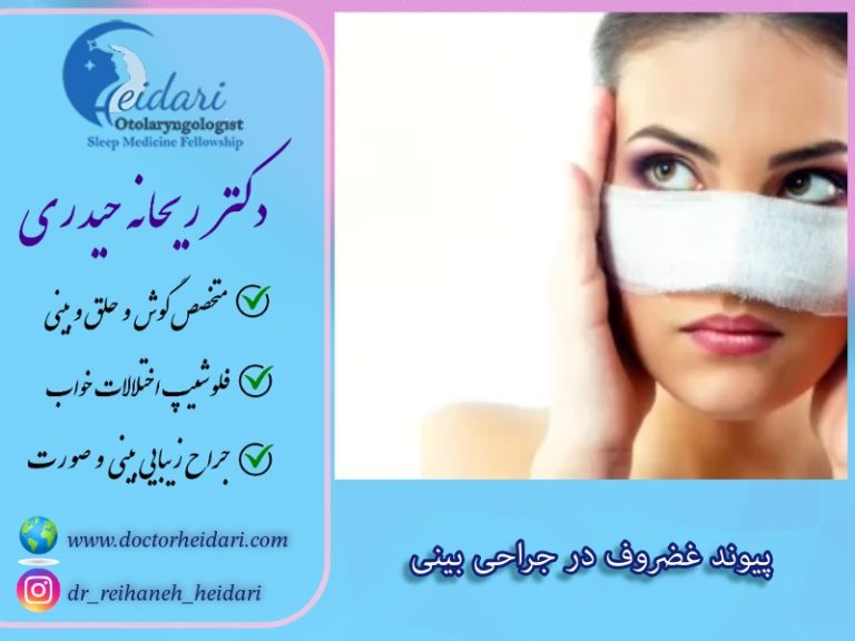 پیوند غضروف در جراحی بینی پیوند غضروف در جراحی بینی