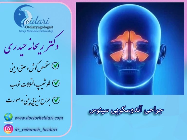 جراحی آندوسکوپی سینوس جراحی آندوسکوپی سینوس