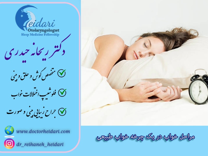 مراحل خواب در یک چرخه خواب طبیعی