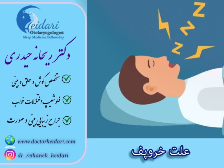 علت خروپف علت خروپف