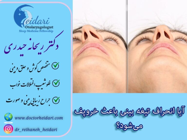 آیا انحراف بینی باعث خروپف میشود؟