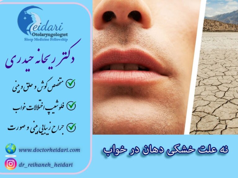 9 علت خشکی دهان در خواب