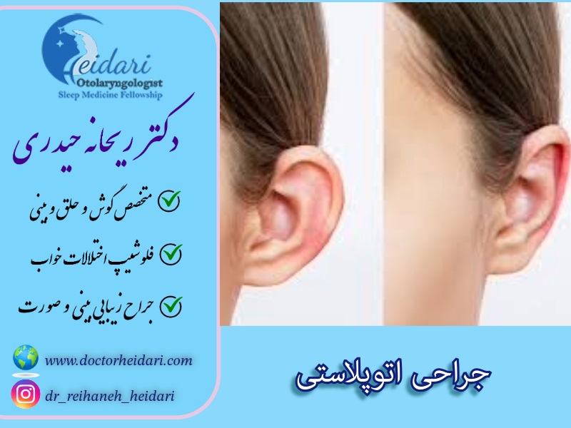 جراحی اتوپلاستی