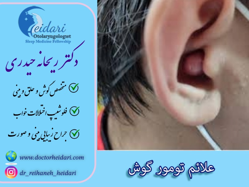 علائم تومور گوش