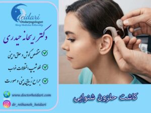 کاشت حلزون گوش
