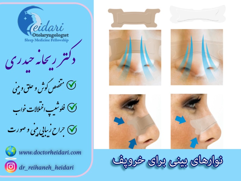 نوارهای بینی برای خروپف