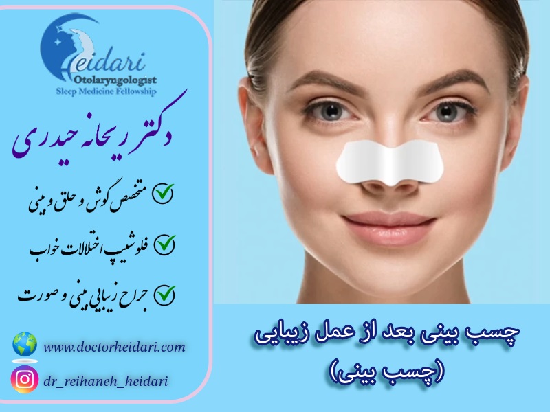 چسب بینی بعد از عمل زیبایی