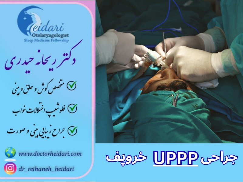 عمل up3