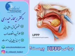 جراحی UPPP چیست جراحی UPPP چیست